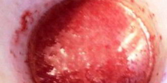 Рецепт клубничного суфле для торта