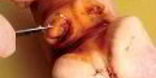 Рецепт холодца гояжьей рульки и копыта